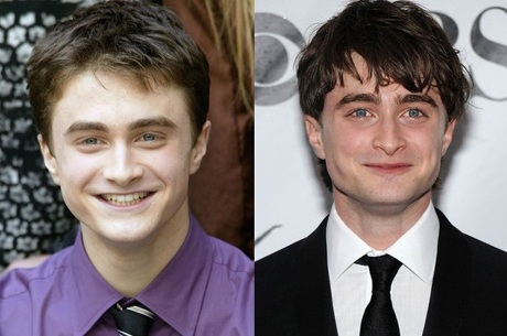 “Sao” Harry Potter xưa và nay - 2 “Sao” Harry Potter xưa và nay - 2