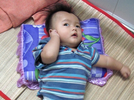 Thương cảnh cháu bé bị di chứng xuất huyết não - 1