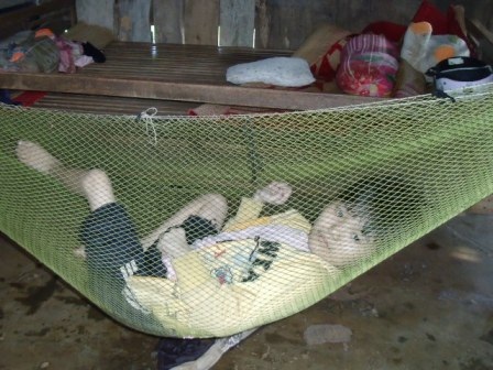 Cháu bé tật nguyền nhiều năm bị “nhốt” trên võng - 1