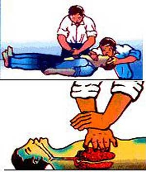 Cấp cứu khi bị điện giật - 2