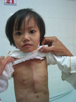 Mong manh trái tim bé bỏng của bé 3 tuổi - 2