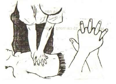 Xử trí khi gặp người đuối nước - 1