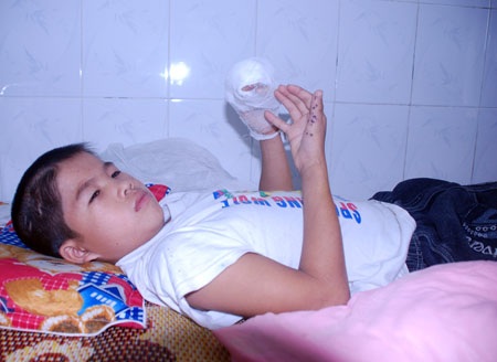 Nghịch kíp mìn, một học sinh phải tháo nhiều ngón tay - 1 Nghịch kíp mìn, một học sinh phải tháo nhiều ngón tay - 1