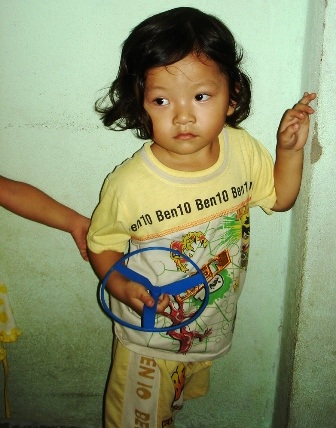 Hình ảnh mới nhất của bé gái 3 tuổi bị tắm kiểu “bạo hành” - 2