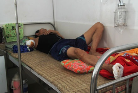 Công nhân đường sắt bị tàu gạt đứt lìa cánh tay - 1 Công nhân đường sắt bị tàu gạt đứt lìa cánh tay - 1