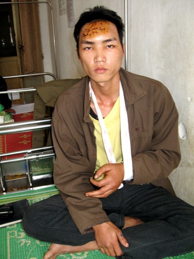 Khỉ độc lại liên tục tấn công người - 1 Khỉ độc lại liên tục tấn công người - 1