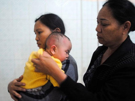 Côn đồ ném xăng, bé gái 7 tháng tuổi bị thương - 1 Côn đồ ném xăng, bé gái 7 tháng tuổi bị thương - 1