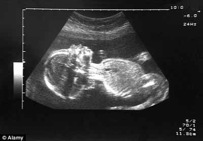 Xét nghiệm máu giúp dự đoán nhiều dị tật thai - 1