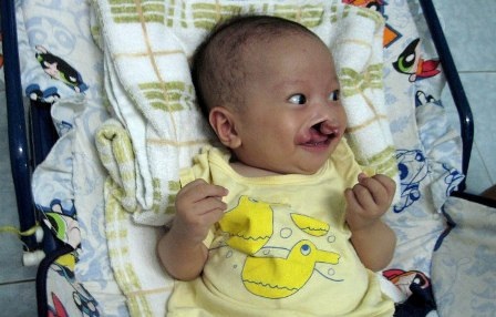 Bé Nhân Nghĩa được kiểm tra tim - 1