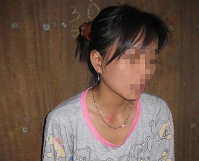 Xôn xao chuyện “cô dâu bỏ trốn” bị gia đình đánh, nhốt - 1 Xôn xao chuyện “cô dâu bỏ trốn” bị gia đình đánh, nhốt - 1