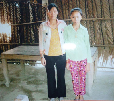 “Bé gái bị bệnh vẹo cột sống” đã được phẫu thuật - 1