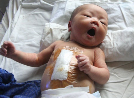 Nước mắt mẹ tuôn rơi khi thấy con được cứu sống - 4 Nước mắt mẹ tuôn rơi khi thấy con được cứu sống - 4