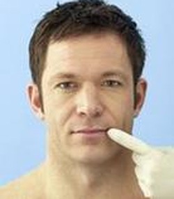 Tại sao bị chốc mép? - 1 Tại sao bị chốc mép? - 1