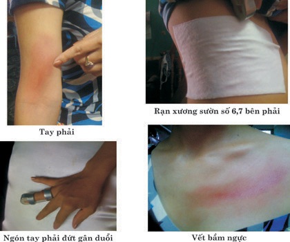 Xử lý hành chính đối tượng đánh người gây thương tích tại 33 Hàng Mã - 1 Xử lý hành chính đối tượng đánh người gây thương tích tại 33 Hàng Mã - 1