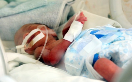 Cứu bé gái 7 ngày tuổi nặng 7 lạng  - 1