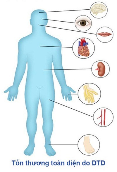 Hộ Tạng Đường: Giải pháp cho bệnh nhân Đái tháo đường - 1 Hộ Tạng Đường: Giải pháp cho bệnh nhân Đái tháo đường - 1