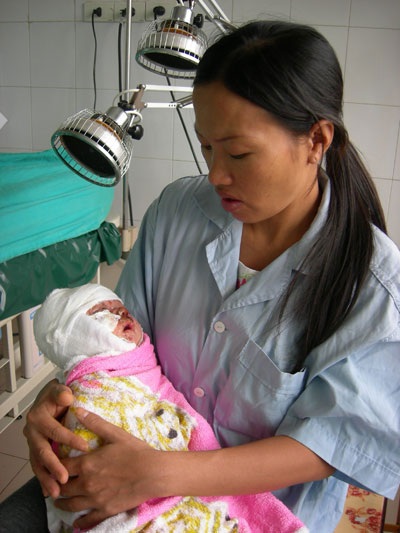 Sưởi ấm, bé trai 1 tháng tuổi rơi vào chậu than - 1 Sưởi ấm, bé trai 1 tháng tuổi rơi vào chậu than - 1
