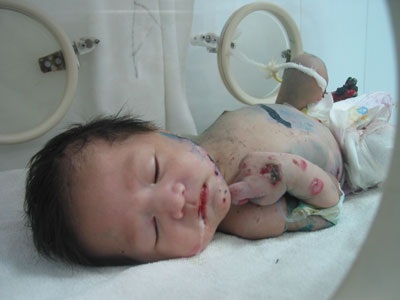 Đôi mắt bé 1 tháng tuổi đã mãi mãi khép lại - 1 Đôi mắt bé 1 tháng tuổi đã mãi mãi khép lại - 1