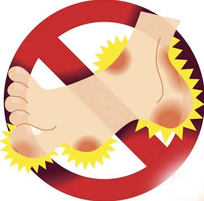 Chứng phù nề do trời lạnh - 1 Chứng phù nề do trời lạnh - 1