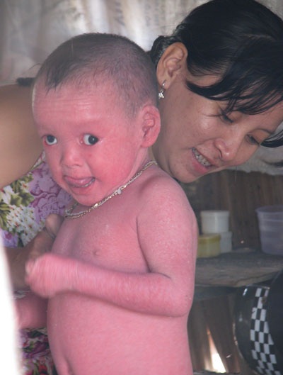 Thăm lại những hoàn cảnh bệnh tật ngày cuối năm - 3