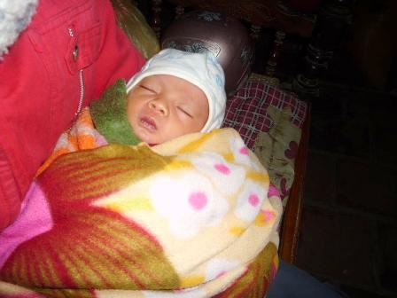 Nỗi đau của người phụ nữ bị vỡ xương sọ sau 7 ngày sinh con - 1