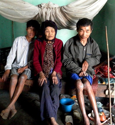 Mẹ già 85 tuổi nuôi hai con tật nguyền - 1