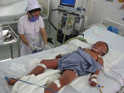 Cứu sống cháu bé bị sốt xuất huyết nặng - 1 Cứu sống cháu bé bị sốt xuất huyết nặng - 1