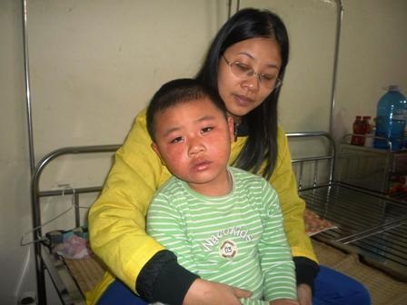 Hàng trăm trẻ em mắc bệnh sốt phát ban - 2