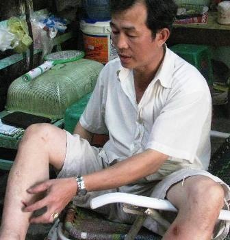 Lộ diện nghi phạm mang súng đi cướp tiệm vàng - 2 Lộ diện nghi phạm mang súng đi cướp tiệm vàng - 2