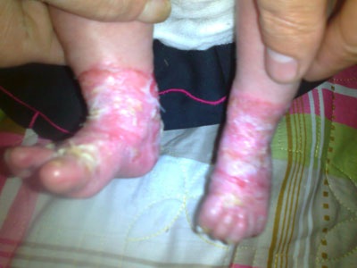 Bệnh tình bé Uyên Nhi ngày mỗi nặng hơn - 2