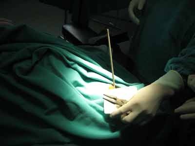 Nghịch ngợm, một trẻ bị thanh sắt đâm xuyên hốc mắt - 3 Nghịch ngợm, một trẻ bị thanh sắt đâm xuyên hốc mắt - 3