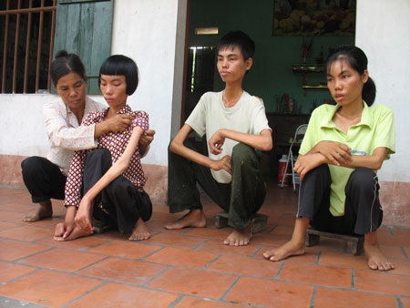 “Giấc mơ hiến tạng” hoàn toàn có thể thành sự thật! - 1 “Giấc mơ hiến tạng” hoàn toàn có thể thành sự thật! - 1