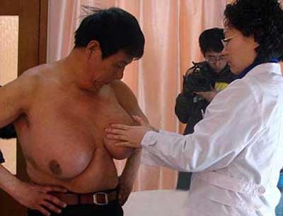 Xử trí với bệnh nữ hóa tuyến vú - 1 Xử trí với bệnh nữ hóa tuyến vú - 1