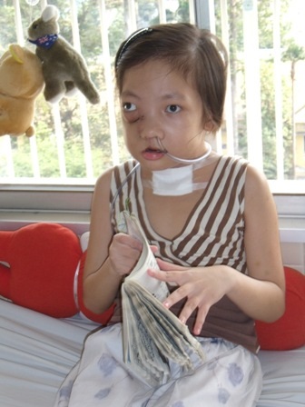 50 bác sĩ “hợp sức” cứu sống cháu bé mắc bệnh hiếm gặp - 2