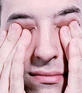 Làm gì khi ngứa mắt? - 1