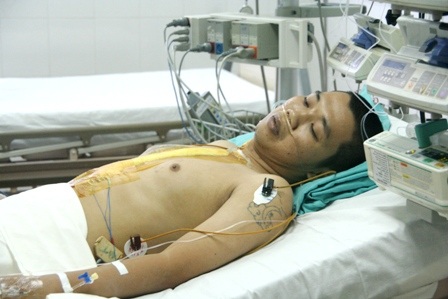 Thành công ca ghép tim do 100% bác sĩ Việt đảm nhiệm - 3