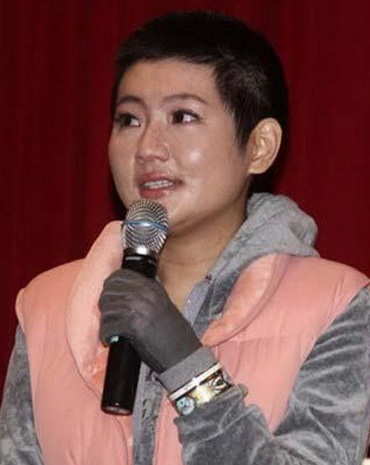 Nữ diễn viên bị bỏng Selina được bồi thường 2 triệu đô Sing - 1