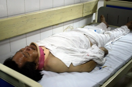 Tạm đình chỉ một Trung tá công an để điều tra vụ dân bị đánh - 1 Tạm đình chỉ một Trung tá công an để điều tra vụ dân bị đánh - 1