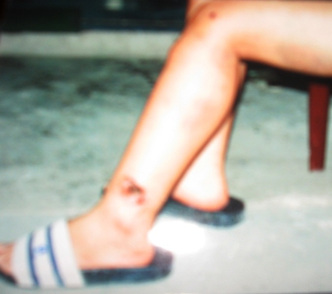 Vụ 2 thiếu nữ bị “cưỡng bức” qua lời kể của nạn nhân - 2