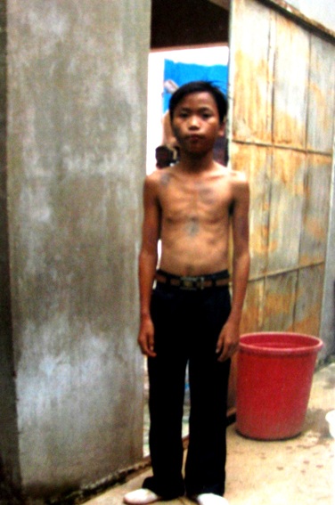 Nhói lòng trước gia đình 5 lần “đào hố” chôn con - 1