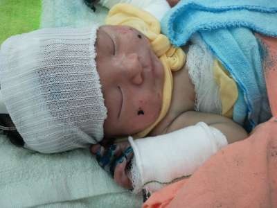 Nỗi buồn của cậu bé mang cái tên “gió bão” - 2 Nỗi buồn của cậu bé mang cái tên “gió bão” - 2