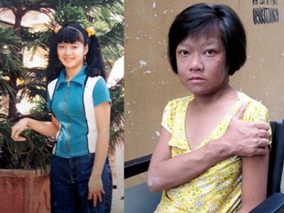 Khát vọng sống còn trên những tờ vé số - 1