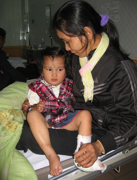 Phẫu thuật nhân đạo cho trẻ khuyết tật - 1