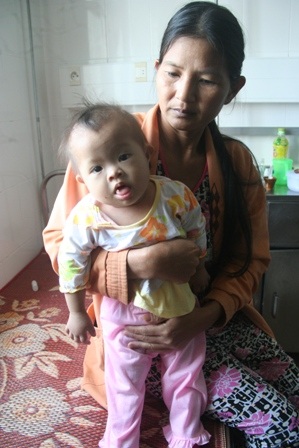 Ca mổ tim của bé Trương Thị Kiều Oanh thành công - 1