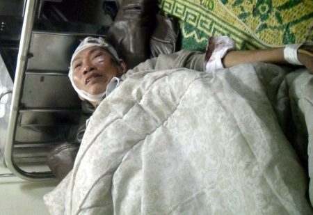 Ký ức kinh hoàng của nạn nhân trong vụ tai nạn 9 người chết  - 3