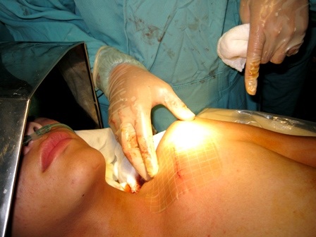 Cậu HS có nguy cơ tử vong đột ngột đã được cứu sống - 1 Cậu HS có nguy cơ tử vong đột ngột đã được cứu sống - 1