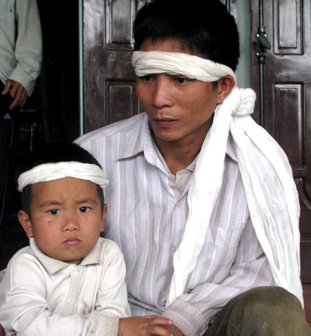 Bàng hoàng lời kể nạn nhân thoát chết trong vụ sập mỏ đá Lèn Cờ - 3