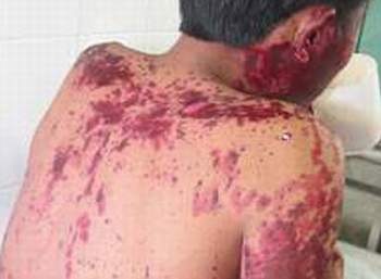 Tự ý dùng thuốc: Chưa nhập viện chưa sợ! - 1