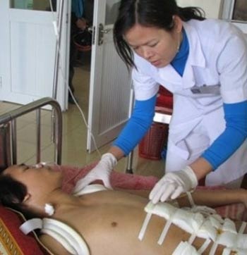 Cứu sống bệnh nhân bị thép đâm thủng ruột non, rách tĩnh mạch - 1 Cứu sống bệnh nhân bị thép đâm thủng ruột non, rách tĩnh mạch - 1