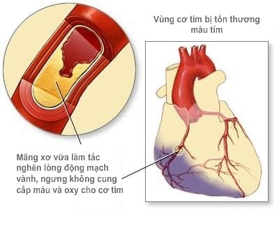 Biến chứng nguy hiểm của bệnh tiểu đường - 4